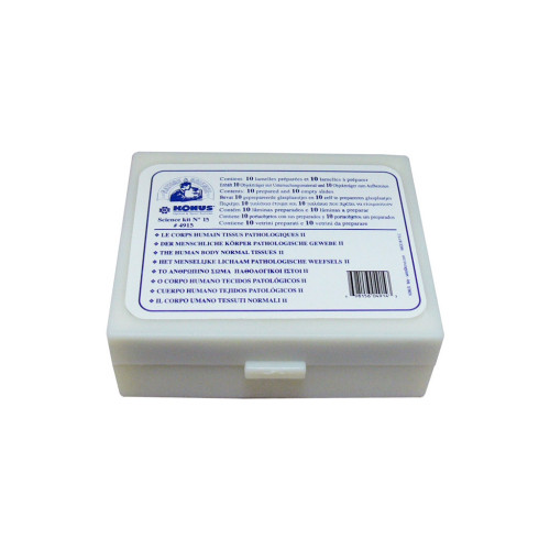 Набор микропрепаратов Konus Патологічні тканини людського тіла, частина II 10 шт (4915) – Konus (вид 3)