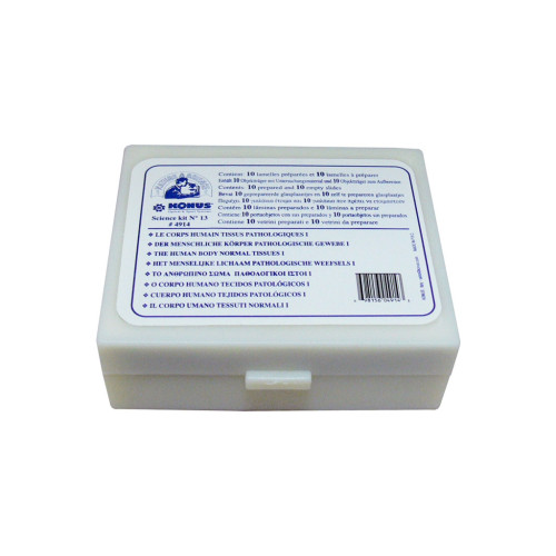 Набор микропрепаратов Konus Патологічні тканини людського тіла, частина I 10 шт (4914) – Konus (вид 3)