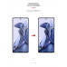 Плівка захисна Armorstandart Anti-spy Xiaomi 11T (ARM61243) – Armorstandart (вид 2)
